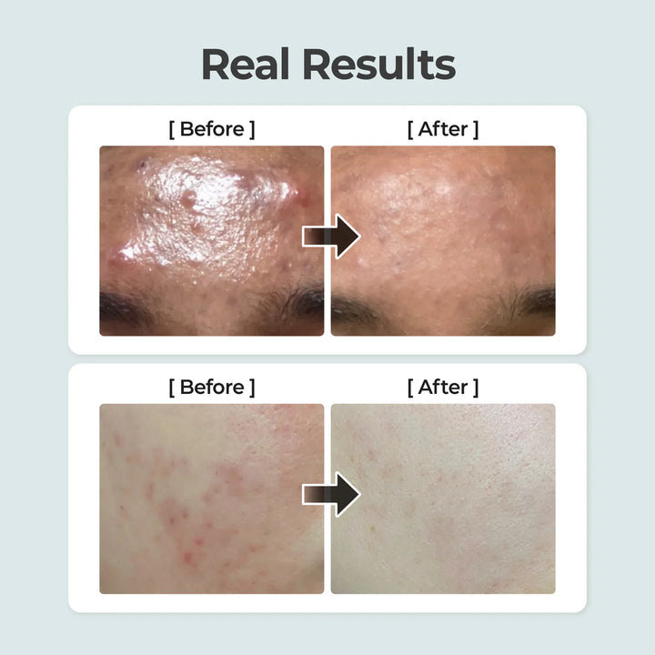 NUMBUZIN No.1 Pure-Full Calming Herb Toner 100ml