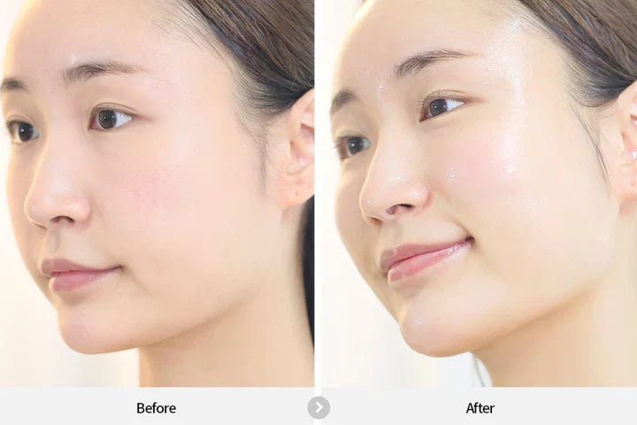 REJURAN Healer Dual Effect Ampoule 30ml new, SKIN CARE, Treatments, Serum & Essence