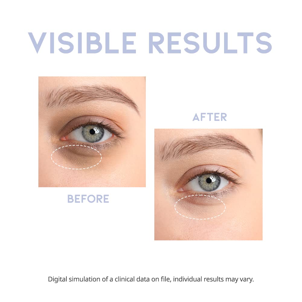 OOTD Intensive Eye Serum 30g eye-serum, new, SKIN CARE, Treatments, Serum & Essence