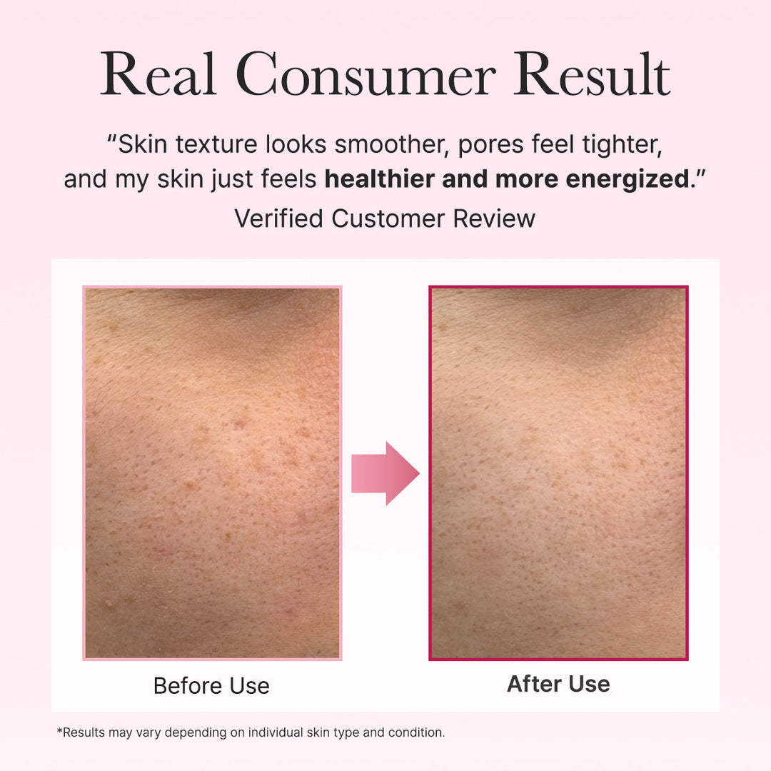 ARENCIA PDRN Booster Shot 30ml before and after 