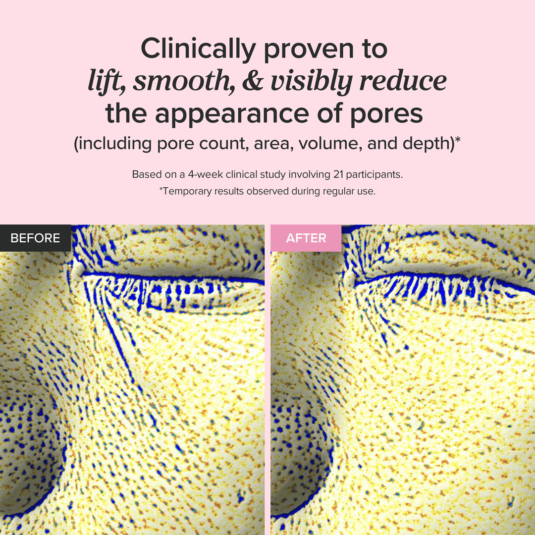 Before and after comparison of skin texture with text claiming clinical proven effects on pores.