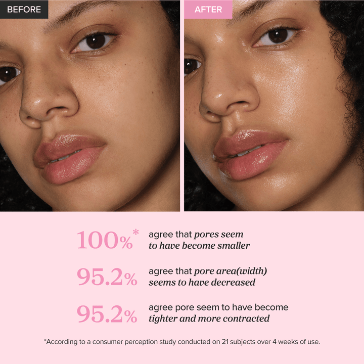 Before and after comparison of a woman's face with text indicating pore size changes.
