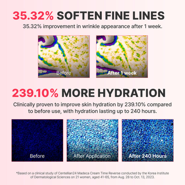 An informational marketing graphic for a skincare cream with text claims about softening fine lines and improving hydration, plus before-and-after skin close-ups and a small clinical-study footnote at the bottom.
