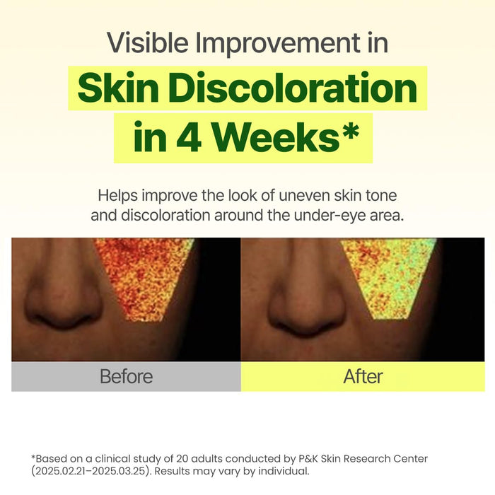 Promotional graphic for a skincare product showing before-and-after results on under-eye skin discoloration. The top text reads 'Visible Improvement in Skin Discoloration in 4 Weeks' on a pale beige background, with a small product bottle partially visible at the bottom center.