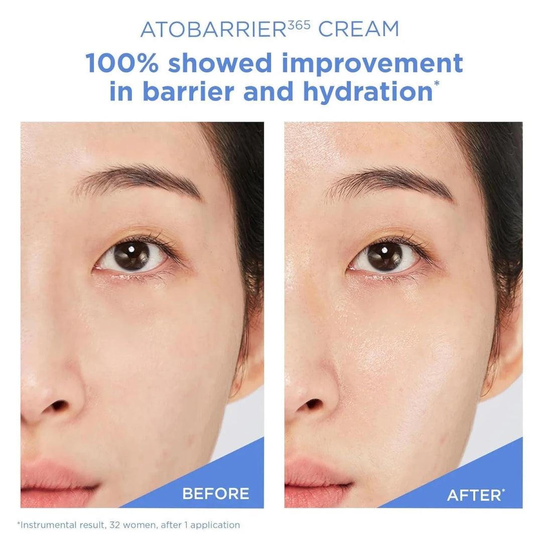 AESTURA ATOBARRIER 365 Cream 30ml – High - Density Ceramide Moisture Barrier Cream Moisturizer 8