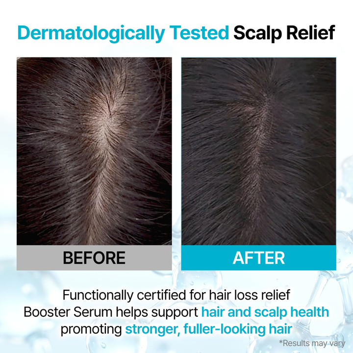 GROWUS Recover Therapy Hair Booster Serum 15ml SKIN CARE, Treatments, Serum & Essence