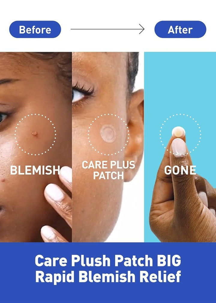 CARE PLUS Spot Patch 15Pcs Health & Beauty oceanbuy beauty markham toronto free ship USA asian korean skincare