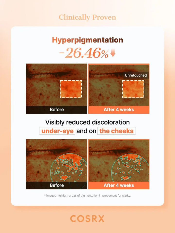 COSRX 5 PDRN Collagen Eye Patches Brightening Dark Circles 60 patches 7