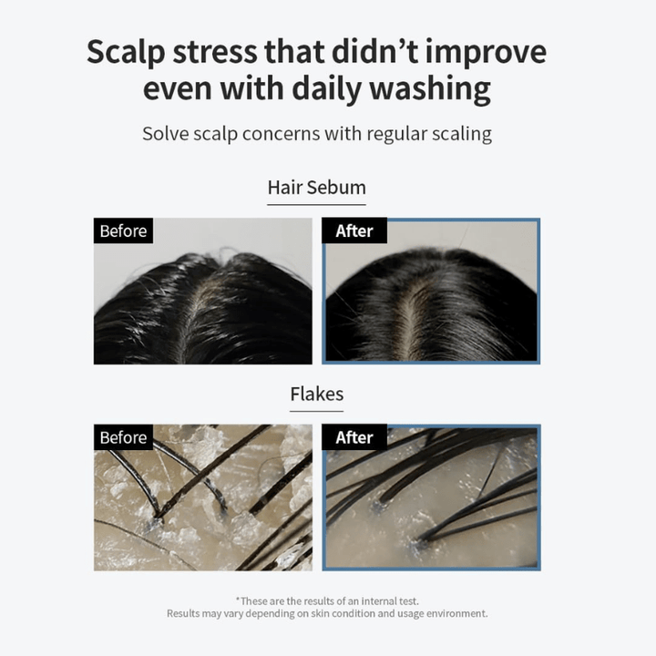 GROWUS Sea Salt Therapy Scalp Scaler 120g Hair 4