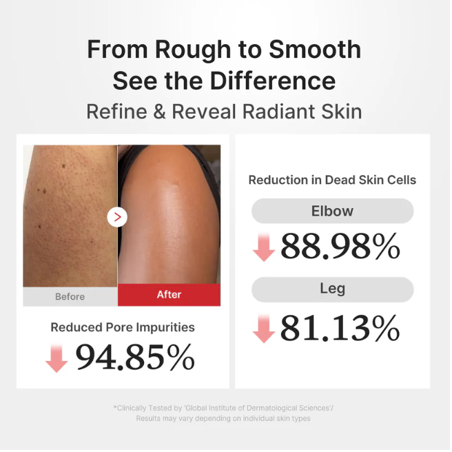 Before-and-after skin comparison infographic showing a close-up of a leg with rough, pigmented skin before and smoother, clearer skin after. Text reads 'From Rough to Smooth See the Difference Refine & Reveal Radiant Skin' with statistics for reduced dead skin cells and pore impurities on the elbow and leg.