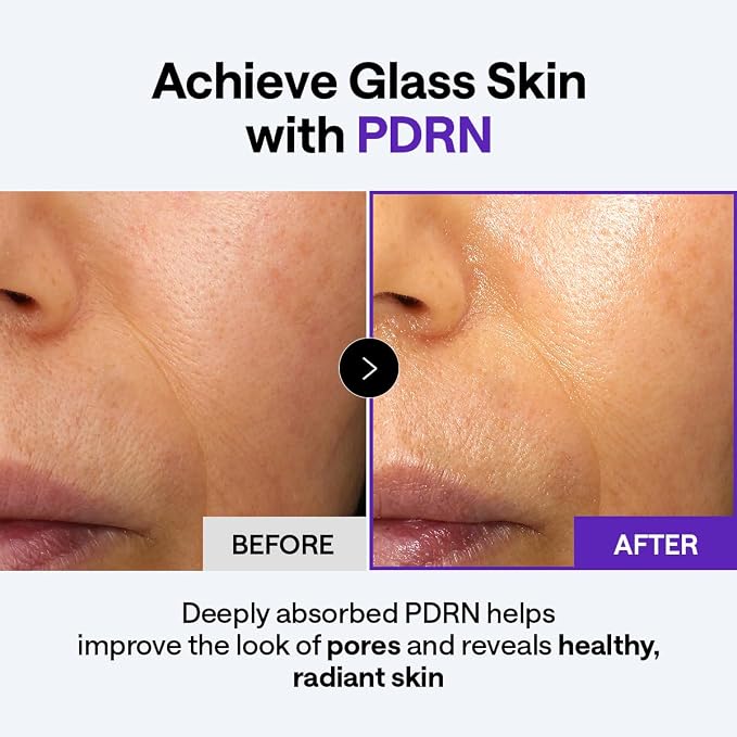 Mediheal PDRN Lifting Derma Cream 50ml Ceramide, Hyaluronic Acid, Niacinamide, Panthenol, PDRN, Peptides, PHA, Squalane