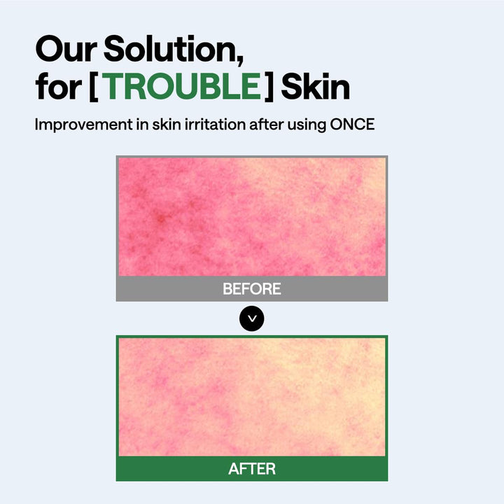 MEDIHEAL Teatree Wrapping Serum Mask 5