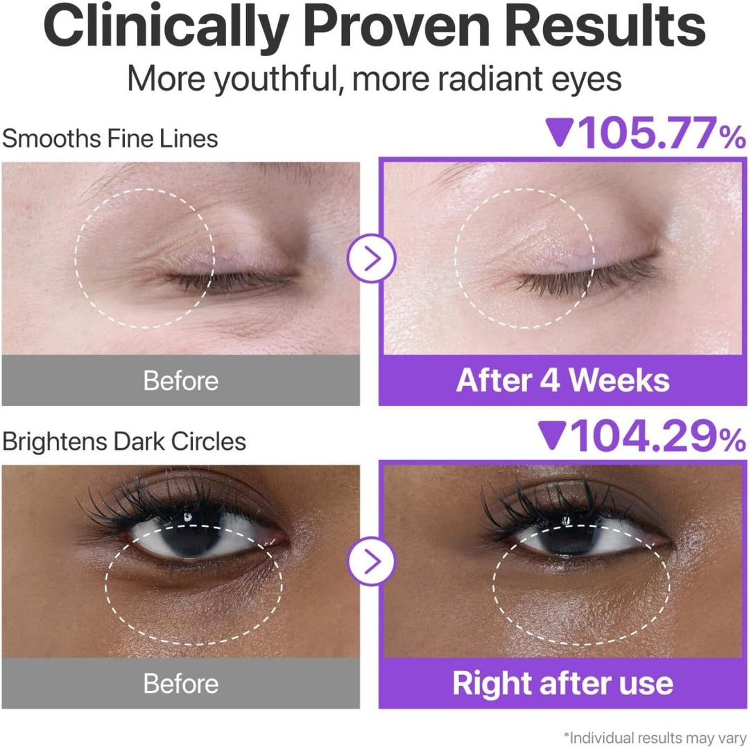 NUMBUZIN No.9 NAD+ Retinol Volumetox Eye Cream 10ml Health & Beauty 4