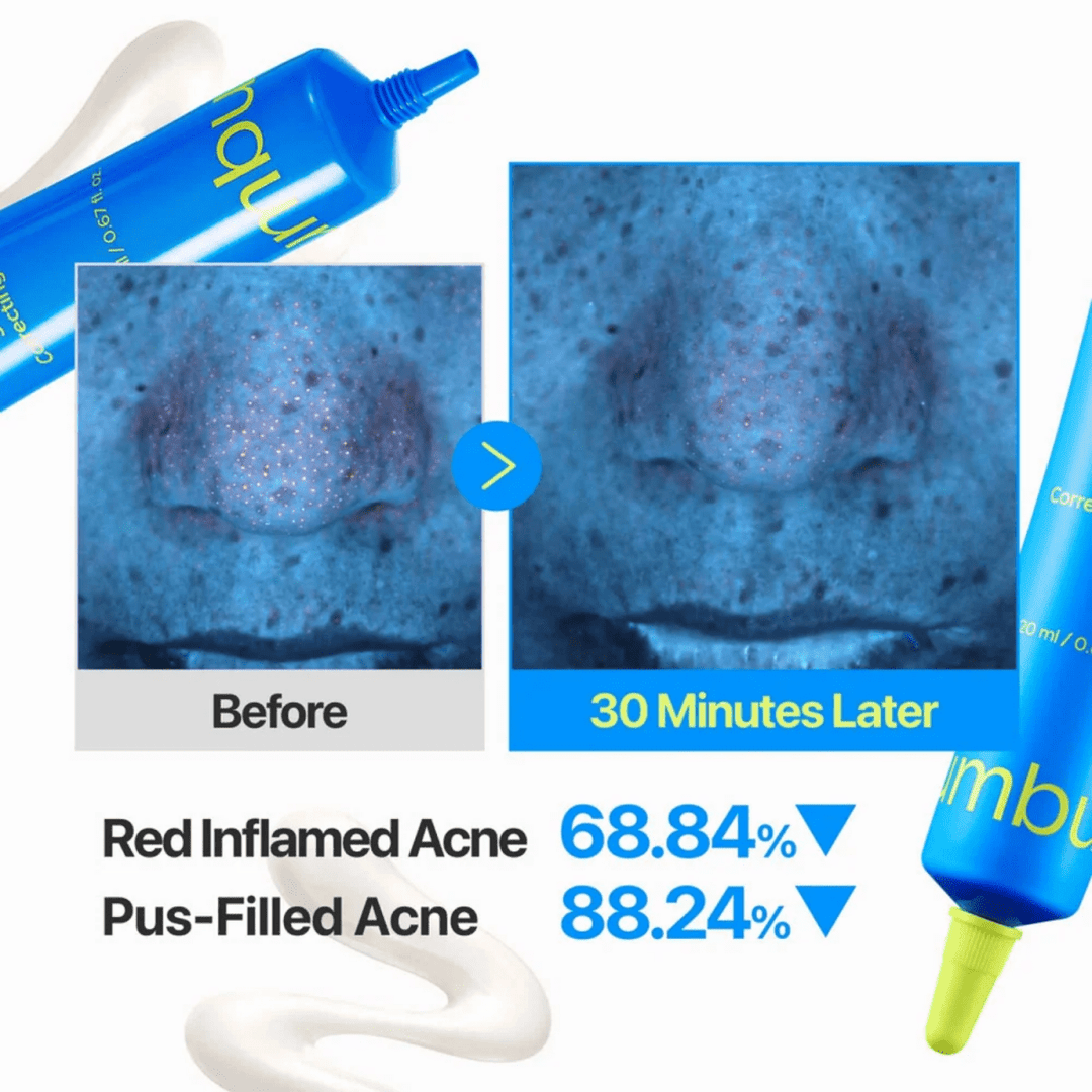 numbuzin Zero Blemish 3X Spot Correcting Cream 20ml Cream 6