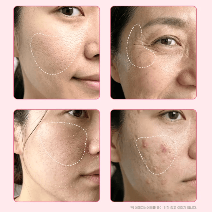 OOTD PDRN Peptide Glass Skin Cream 50ml Ceramide, Niacinamide, Panthenol, PDRN, Peptides, Squalane, SKIN CARE, Moisturizers, Facial Moisturizers