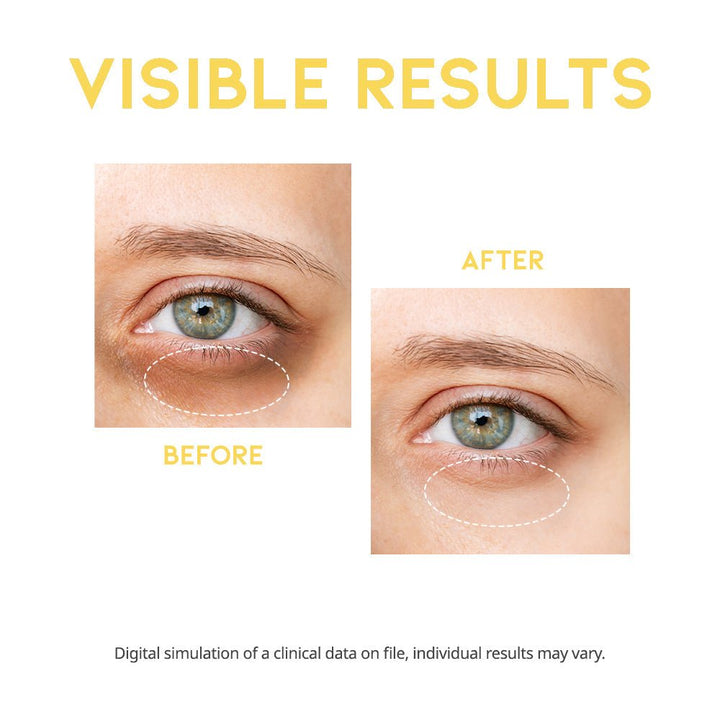 OOTD Dark Circle Eye Serum 30g Eye Cream & Serum 2