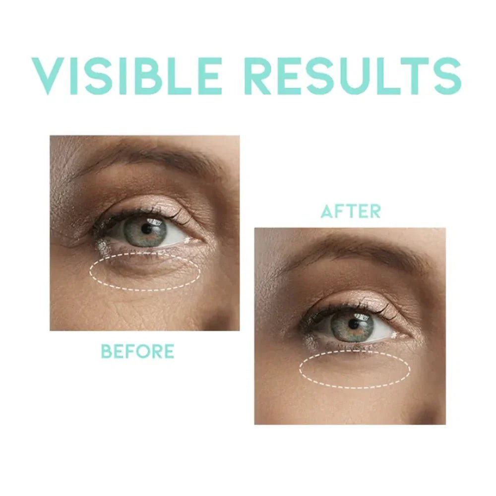 OOTD Wrinkle Lift Eye Serum 30g Eye Cream & Serum 3