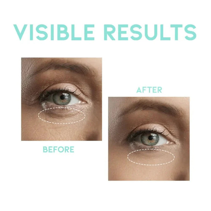 OOTD Wrinkle Lift Eye Serum 30g Eye Cream & Serum 3