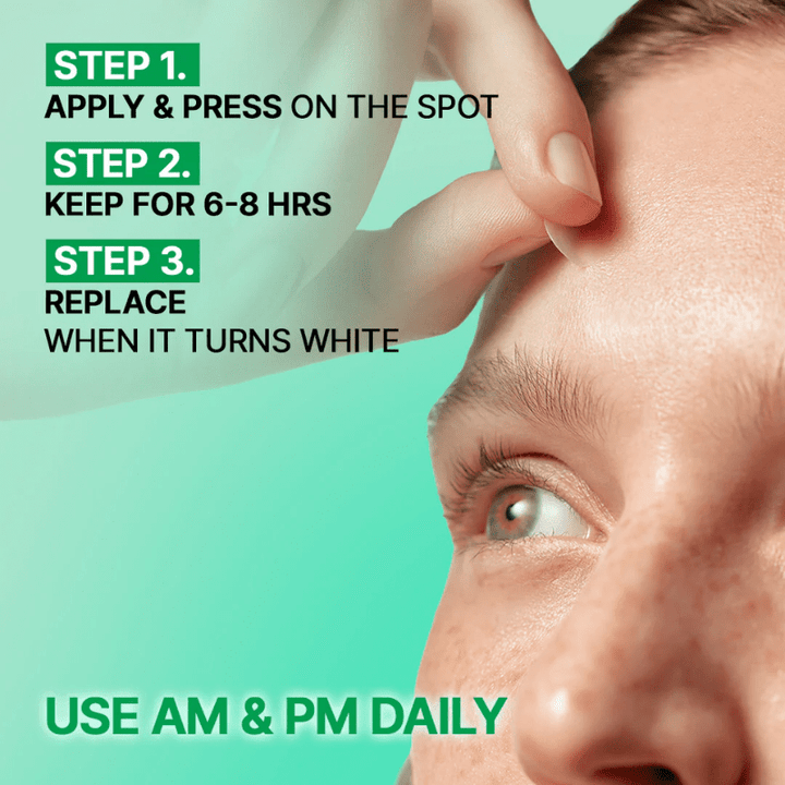 Parnell Cicamanu Clear Patch Spot Treatment 48ea Patch 6