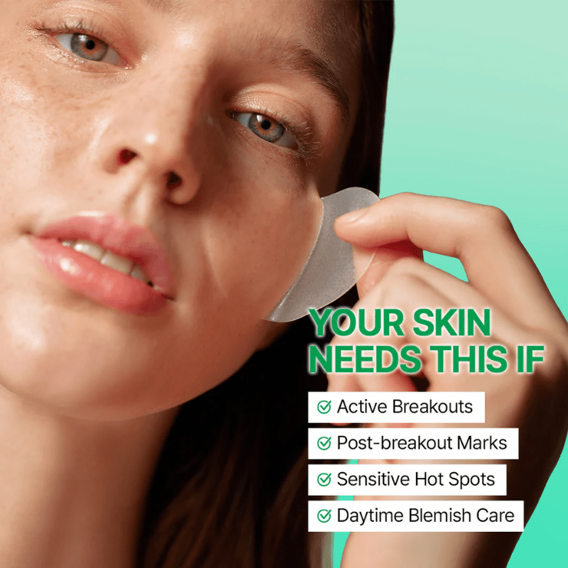 Parnell Cicamanu Clear Patch Spot Treatment 48ea Patch 5