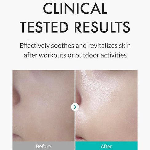 REJURAN Skin Protection Mask c-PDRN Hydration 5 Pieces Sheet Mask 4