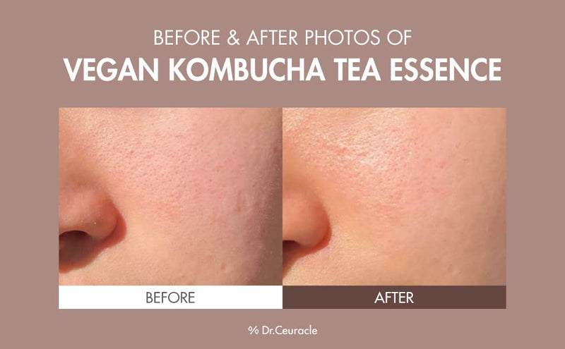 DR. CEURACLE Vegan Kombucha Tea Essence 150ml - OCEANBUY.ca